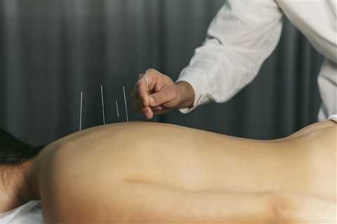 What Training Do The Acupuncturists Have At Modern Acupuncture?